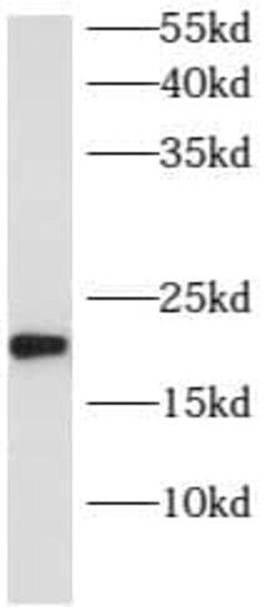 ARL8B Antibody - BSA Free, Novus Biologicals 100 &mu;g | Buy Online | Novus Biologicals | Fisher Scientific