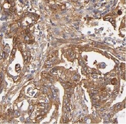 ARHGDIG Antibody - BSA Free, Novus Biologicals 100 &mu;g | Buy Online | Novus Biologicals | Fisher Scientific