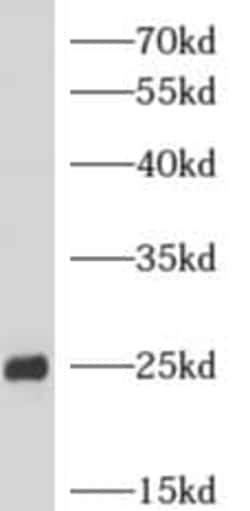 ARHGDIG Antibody - BSA Free, Novus Biologicals 100 &mu;g | Buy Online | Novus Biologicals | Fisher Scientific