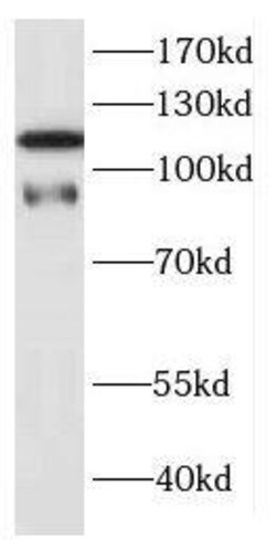 DNAJC6 Antibody - BSA Free, Novus Biologicals 100 &mu;g | Buy Online | Novus Biologicals | Fisher Scientific