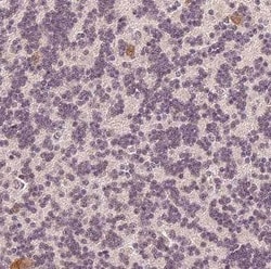 DNAJC6 Antibody - BSA Free, Novus Biologicals 100 &mu;g | Buy Online | Novus Biologicals | Fisher Scientific