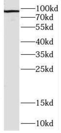 DNAJC16 Antibody - BSA Free, Novus Biologicals 100 &mu;g | Buy Online | Novus Biologicals | Fisher Scientific