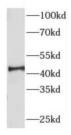 DNAJB14 Antibody - BSA Free, Novus Biologicals 100 &mu;g | Buy Online | Novus Biologicals | Fisher Scientific