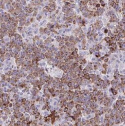 DMGDH Antibody - BSA Free, Novus Biologicals 100 &mu;g | Buy Online | Novus Biologicals | Fisher Scientific