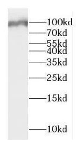 DMGDH Antibody - BSA Free, Novus Biologicals 100 &mu;g | Buy Online | Novus Biologicals | Fisher Scientific