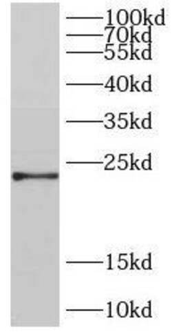 DIRAS2 Antibody - BSA Free, Novus Biologicals 100 &mu;g | Buy Online | Novus Biologicals | Fisher Scientific