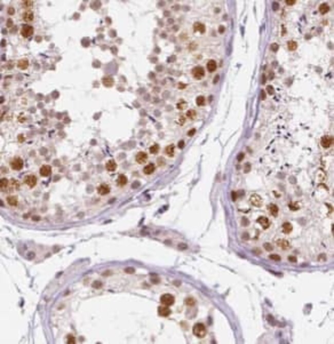 DHX35 Antibody - BSA Free, Novus Biologicals 100 μg; Unconjugated ...