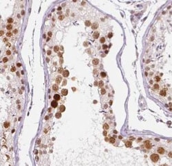 DHX32 Antibody - BSA Free, Novus Biologicals 100 &mu;g | Buy Online | Novus Biologicals | Fisher Scientific