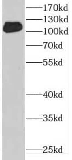 DENND1A Antibody - BSA Free, Novus Biologicals 100 &mu;g | Buy Online | Novus Biologicals | Fisher Scientific
