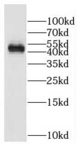DDI1 Antibody - BSA Free, Novus Biologicals 100 &mu;g | Buy Online | Novus Biologicals | Fisher Scientific