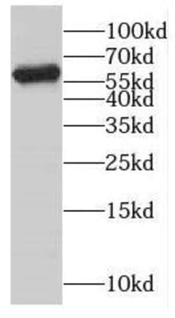 CYP4F3 Antibody - BSA Free, Novus Biologicals 100 &mu;g | Buy Online | Novus Biologicals | Fisher Scientific