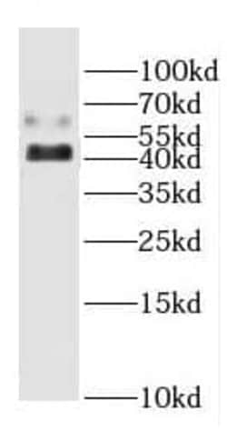 CYP20A1 Antibody - BSA Free, Novus Biologicals 100 &mu;g | Buy Online | Novus Biologicals | Fisher Scientific