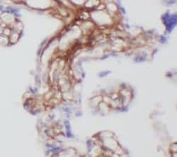 CT83 Antibody - BSA Free, Novus Biologicals 100 &mu;g | Buy Online | Novus Biologicals | Fisher Scientific