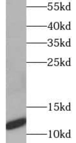 CT83 Antibody - BSA Free, Novus Biologicals 100 &mu;g | Buy Online | Novus Biologicals | Fisher Scientific