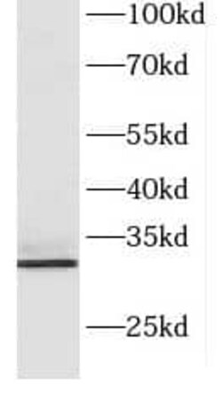 CXorf56/MRX107 Antibody - BSA Free, Novus Biologicals 100 &mu;g | Buy Online | Novus Biologicals | Fisher Scientific