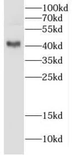 CRYZL1 Antibody - BSA Free, Novus Biologicals 100 &mu;g | Buy Online | Novus Biologicals | Fisher Scientific