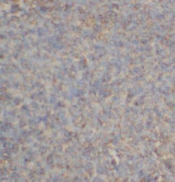 CSTP1 Antibody - BSA Free, Novus Biologicals 100 &mu;g | Buy Online | Novus Biologicals | Fisher Scientific