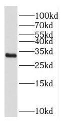 CSTP1 Antibody - BSA Free, Novus Biologicals 100 &mu;g | Buy Online | Novus Biologicals | Fisher Scientific