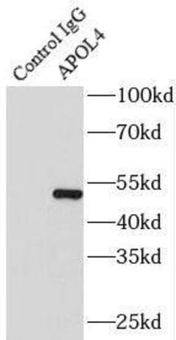 Apolipoprotein L4 Antibody - BSA Free, Novus Biologicals 100 &mu;g | Buy Online | Novus Biologicals | Fisher Scientific