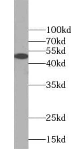 AP1M1 Antibody - BSA Free, Novus Biologicals 100 &mu;g | Buy Online | Novus Biologicals | Fisher Scientific