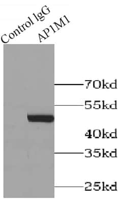 AP1M1 Antibody - BSA Free, Novus Biologicals 100 &mu;g | Buy Online | Novus Biologicals | Fisher Scientific