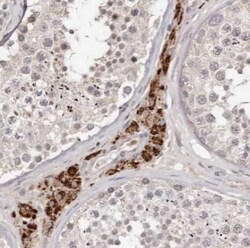 TMEM16K Antibody - BSA Free, Novus Biologicals 100 &mu;g | Buy Online | Novus Biologicals | Fisher Scientific
