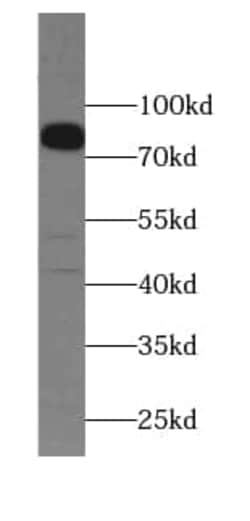 TMEM16K Antibody - BSA Free, Novus Biologicals 100 &mu;g | Buy Online | Novus Biologicals | Fisher Scientific