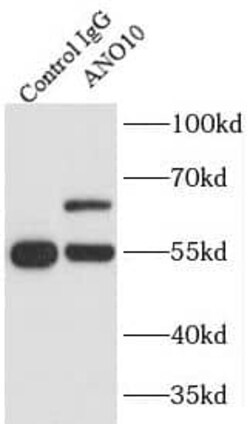 TMEM16K Antibody - BSA Free, Novus Biologicals 100 &mu;g | Buy Online | Novus Biologicals | Fisher Scientific