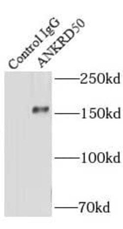 ANKRD50 Antibody - BSA Free, Novus Biologicals 100 &mu;g | Buy Online | Novus Biologicals | Fisher Scientific