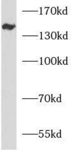 ANKRD50 Antibody - BSA Free, Novus Biologicals 100 &mu;g | Buy Online | Novus Biologicals | Fisher Scientific