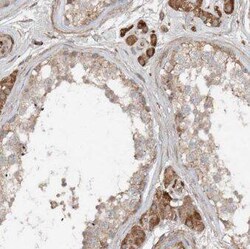 ANKRD13C Antibody - BSA Free, Novus Biologicals 100 &mu;g | Buy Online | Novus Biologicals | Fisher Scientific