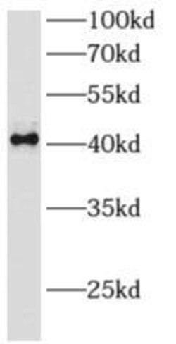 Archaemetzincin 2 Antibody - BSA Free, Novus Biologicals 100 &mu;g | Buy Online | Novus Biologicals | Fisher Scientific