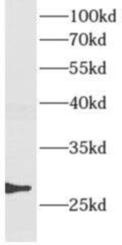 AMN1 Antibody - BSA Free, Novus Biologicals 100 &mu;g | Buy Online | Novus Biologicals | Fisher Scientific