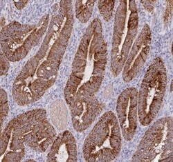 AMN1 Antibody - BSA Free, Novus Biologicals 100 &mu;g | Buy Online | Novus Biologicals | Fisher Scientific