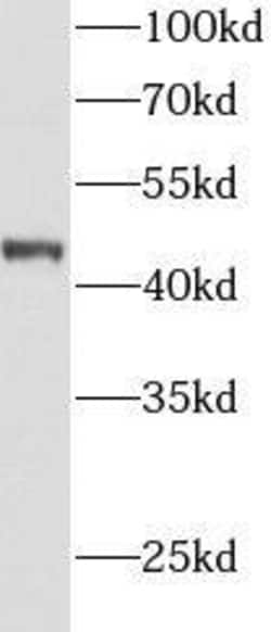 AGXT Antibody - BSA Free, Novus Biologicals 100 &mu;g | Buy Online | Novus Biologicals | Fisher Scientific