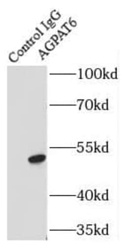AGPAT6 Antibody - BSA Free, Novus Biologicals 100 &mu;g; Unconjugated:Antibodies,