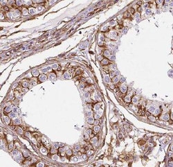 AGPAT6 Antibody - BSA Free, Novus Biologicals 100 &mu;g; Unconjugated:Antibodies,