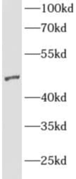 AGFG2 Antibody - BSA Free, Novus Biologicals 100 &mu;g | Buy Online | Novus Biologicals | Fisher Scientific