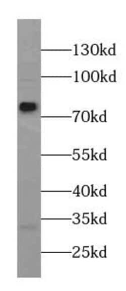 AGBL5 Antibody - BSA Free, Novus Biologicals 100 &mu;g | Buy Online | Novus Biologicals | Fisher Scientific