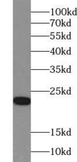 ACOT6 Antibody - BSA Free, Novus Biologicals 100 &mu;g | Buy Online | Novus Biologicals | Fisher Scientific