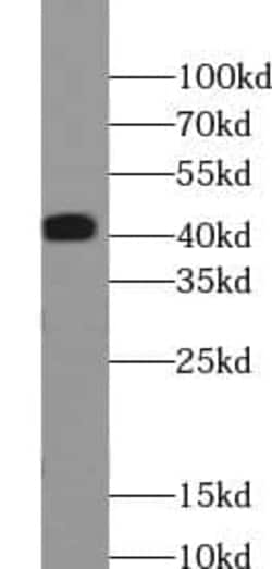 ABHD12B Antibody - BSA Free, Novus Biologicals 100 &mu;g | Buy Online | Novus Biologicals | Fisher Scientific