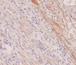 ABHD12B Antibody - BSA Free, Novus Biologicals 100 &mu;g | Buy Online | Novus Biologicals | Fisher Scientific