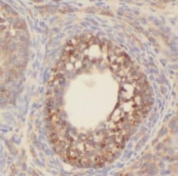 Serotonin N-acetyltransferase Antibody - BSA Free, Novus Biologicals 100 &mu;g | Buy Online | Novus Biologicals | Fisher Scientific