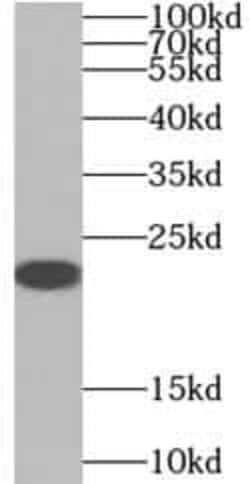 Serotonin N-acetyltransferase Antibody - BSA Free, Novus Biologicals 100 &mu;g | Buy Online | Novus Biologicals | Fisher Scientific