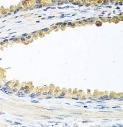 Cochlin Antibody - BSA Free, Novus Biologicals 100 &mu;g | Buy Online | Novus Biologicals | Fisher Scientific