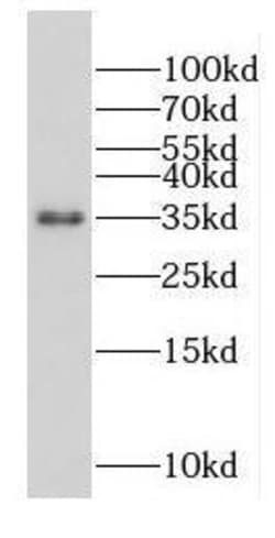 FAM105A Antibody - BSA Free, Novus Biologicals 100 &mu;g | Buy Online | Novus Biologicals | Fisher Scientific