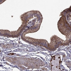 non-muscle Myosin IIA Antibody, Novus Biologicals 0.1mL; Unlabeled:Antibodies,