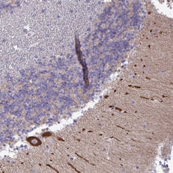 non-muscle heavy chain 10 Myosin Antibody, Novus Biologicals:Antibodies:Primary