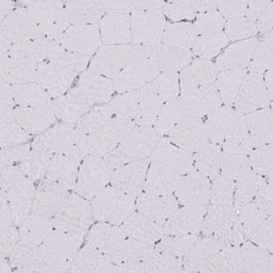non-muscle heavy chain 10 Myosin Antibody, Novus Biologicals 0.1mL; Unlabeled:Antibodies,