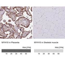 non-muscle heavy chain 10 Myosin Antibody, Novus Biologicals 0.1mL; Unlabeled:Antibodies,